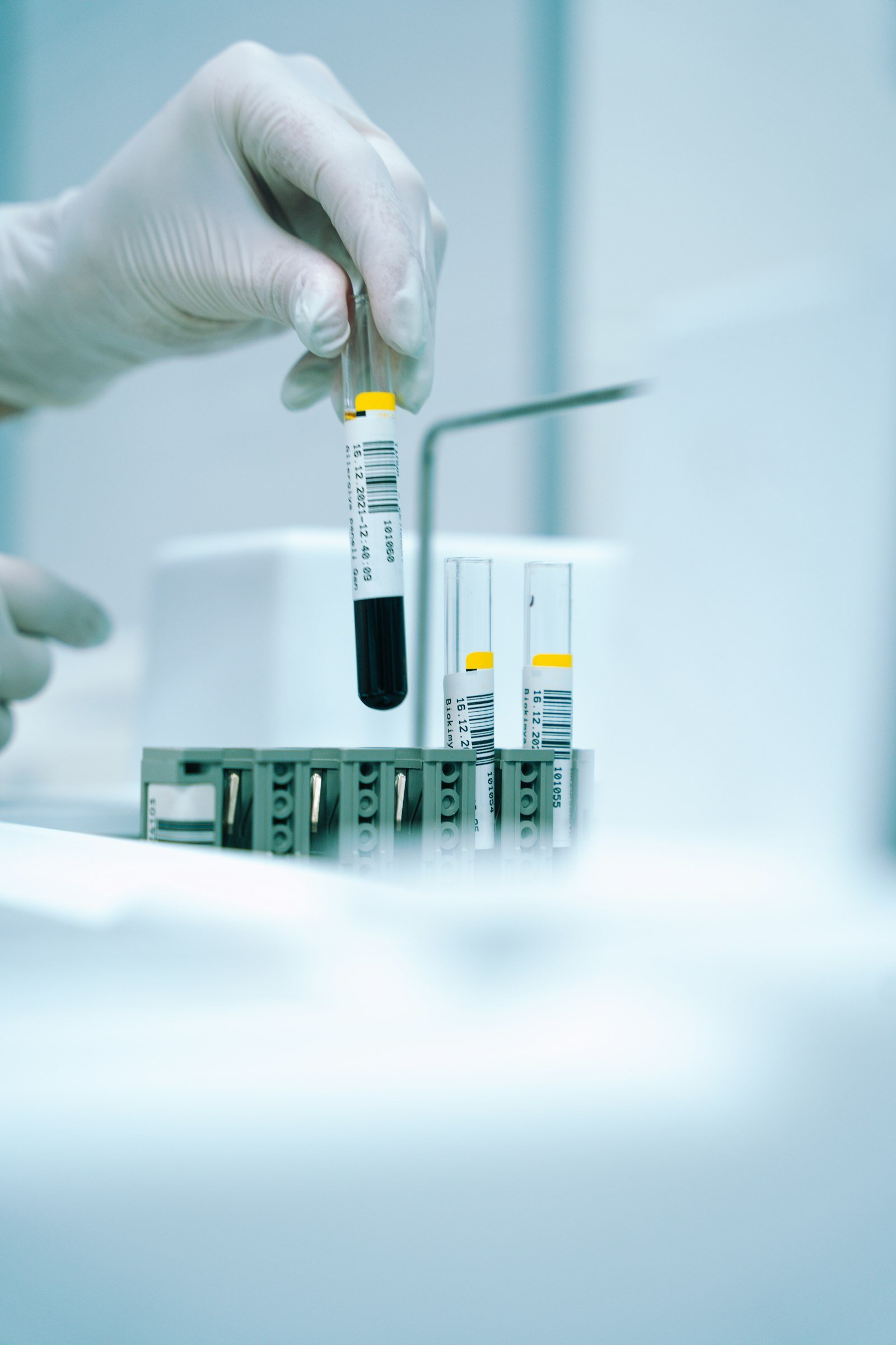 Lab sample tubes for DOT and non-DOT drug testing in Donna, TX